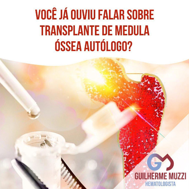 Você já ouviu falar sobre transplante de medula óssea autólogo?