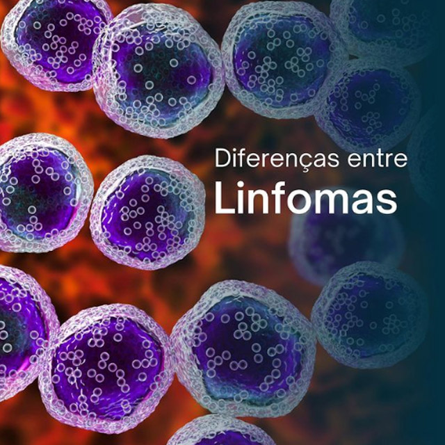 Diferenças entre Linfomas